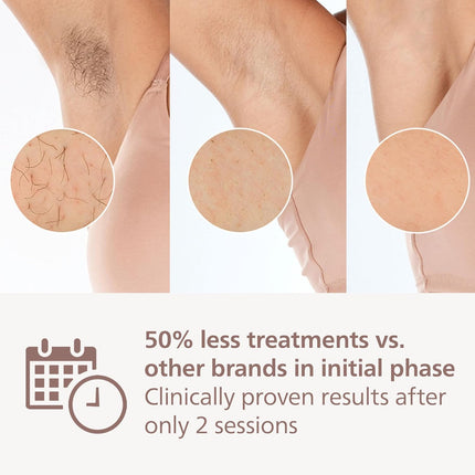 Philips Lumea 8000 Series IPL Hair Removal Device - Laser Hair Removal Alternative, SenseIQ Technology, 4 Attachments for Body, Face, Bikini and Underarms, Satin Compact Pen Trimmer, Model BRI949/00